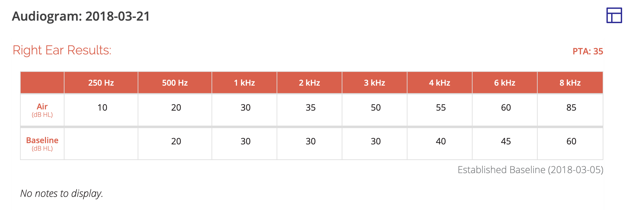 A screenshot of an individual patient's audiogram in Table view.