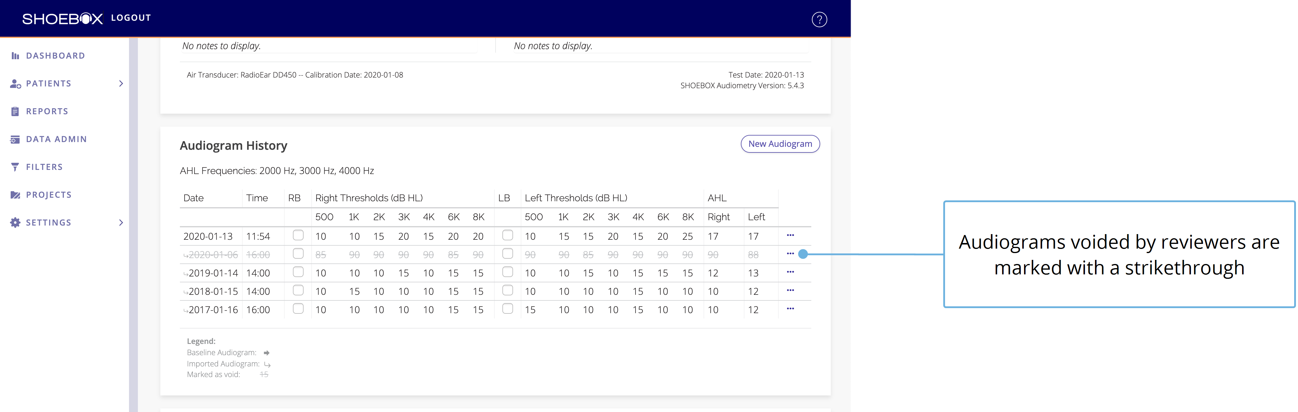 A screenshot of the patient's Audiogram History with a struck out audiogram in the list.
