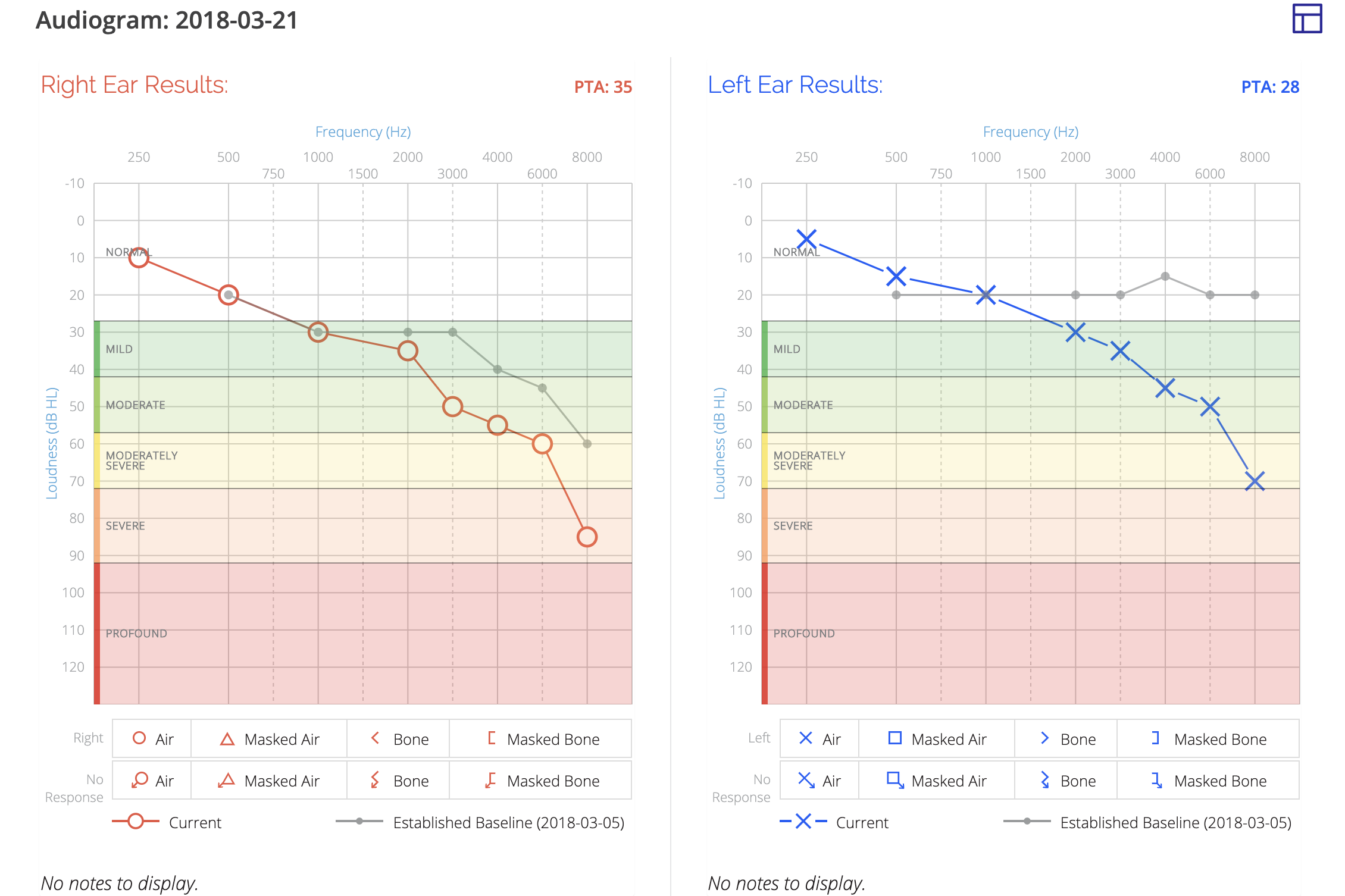 A screenshot of an individual patient's audiogram in Audiogram view.