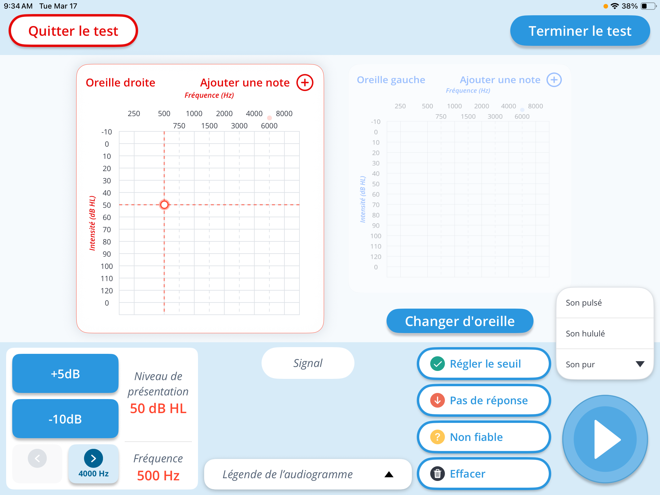 Une capture d'écran de l'interface de test manuel.