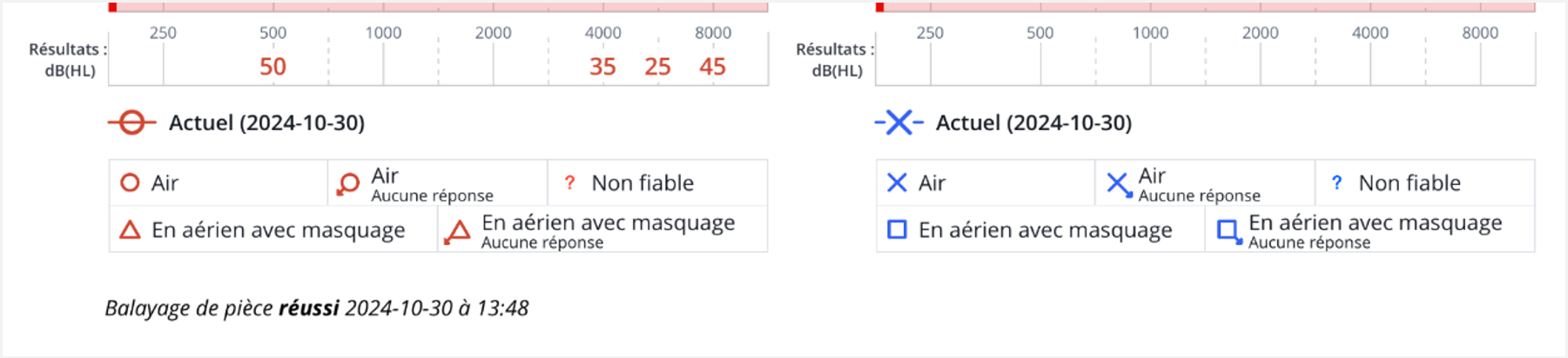 Une capture d'écran présentant les résultats de l'audiogramme d'un test.