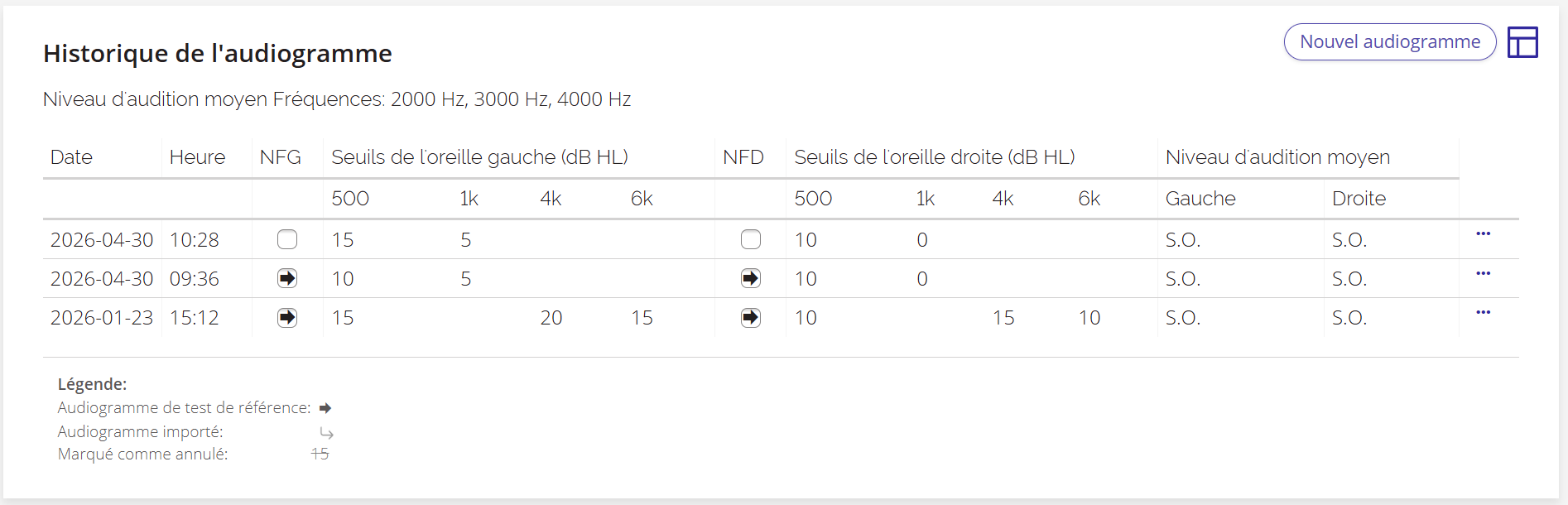 Une capture d'écran de la section « Historique des audiogrammes » sur la page d'un patient.